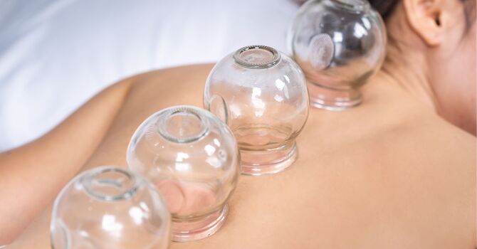 Laser Acupuncture